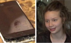 iPhone 5C Terbakar, Gadis 12 Tahun Alami Luka Bakar